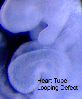 Heart tube looping defect
