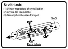 Renal Stone Formation