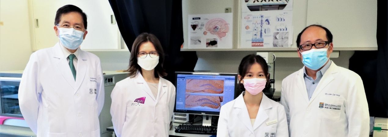 HKUMed & CityU researchers jointly discover non-invasive stimulation of the eye for depression and dementia