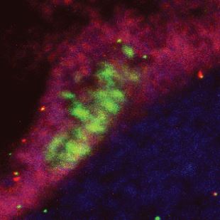 Peripheral neural stem cells (pNSCs)