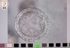 Stem cell