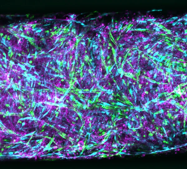 Organ-on-a-chip.png 
